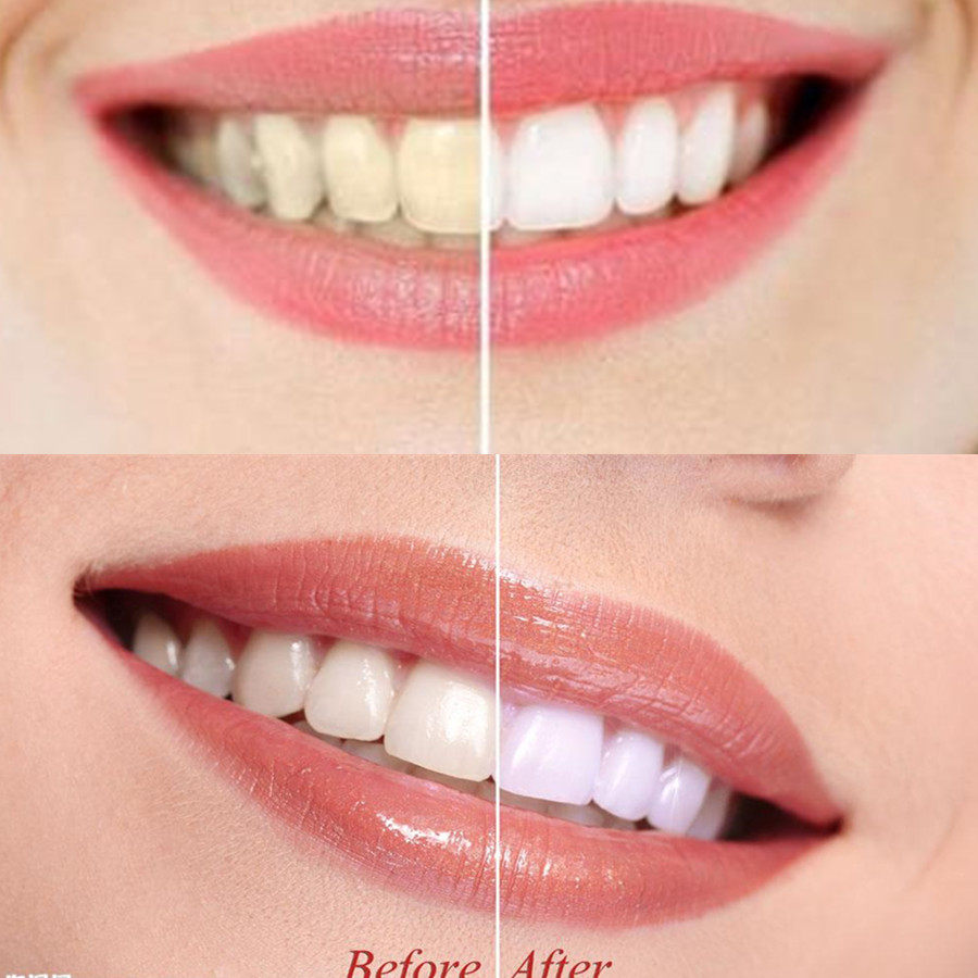 Bamboo Charcoal Teeth Tooth De - Teeth Whitening Ingredients ulasan dan harga