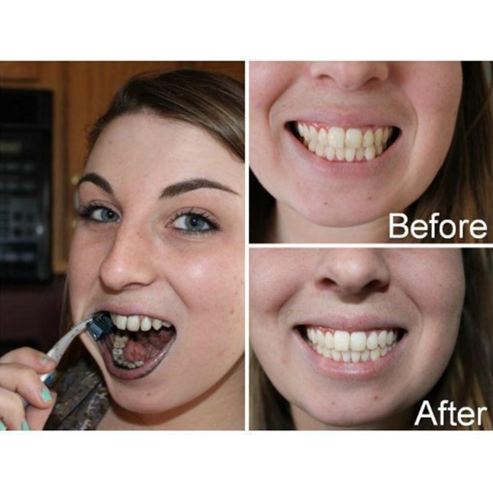 Bamboo Charcoal Teeth Tooth De - Teeth Whitening Ingredients ulasan dan harga