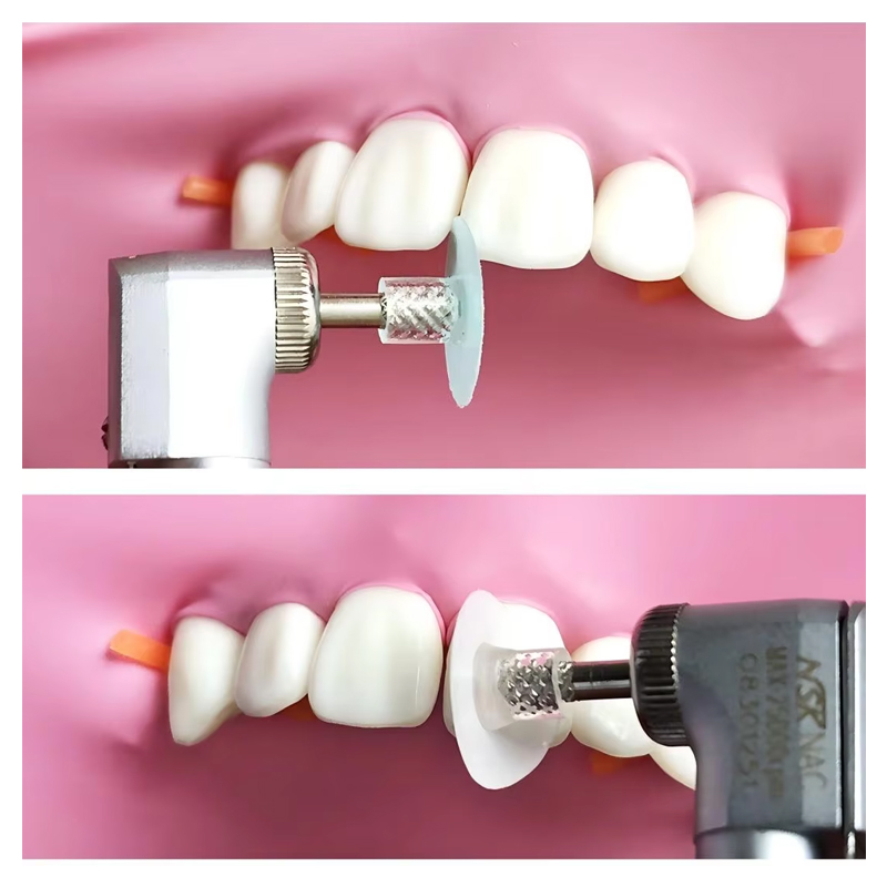 40Pcs Dental Polishing Disc Co - Teeth Whitening Home ulasan dan harga