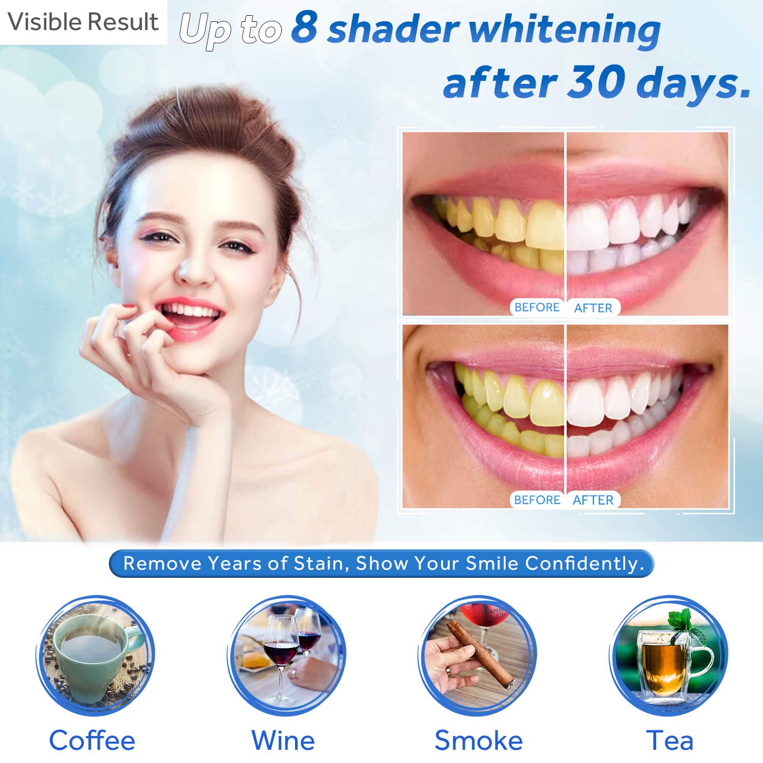 Teeth Whitening Gel Refill Syr - Teeth Whitening Q&M ulasan dan harga