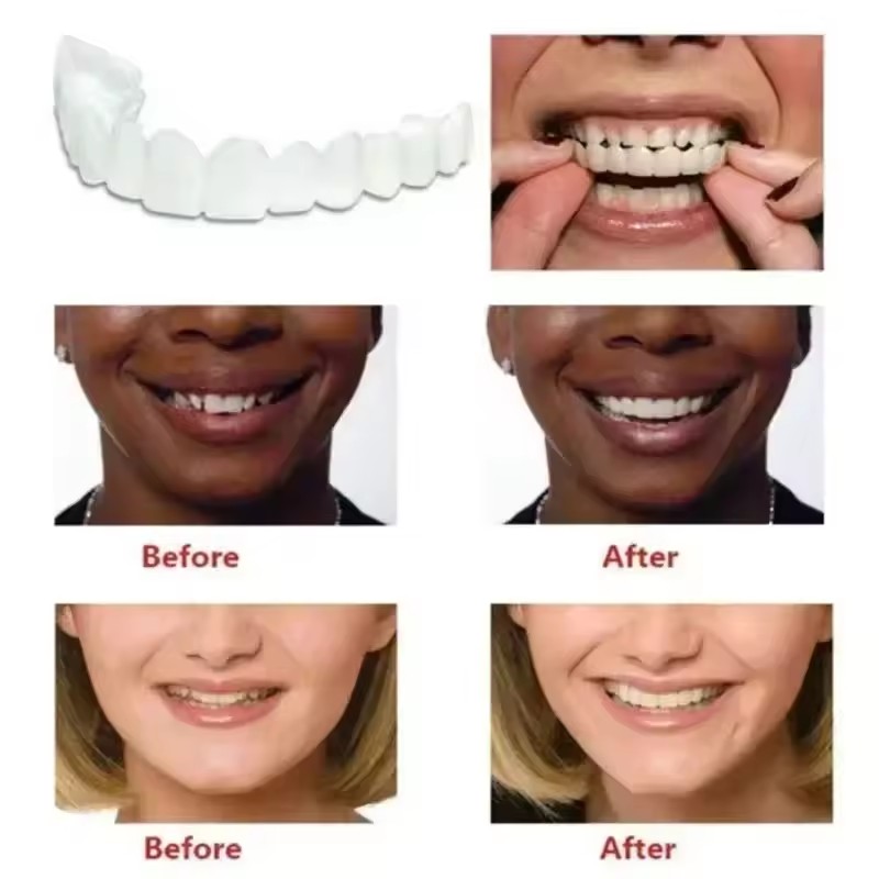 Teeth Veneers Whitening Dentur - Teeth Whitening Vape ulasan dan harga