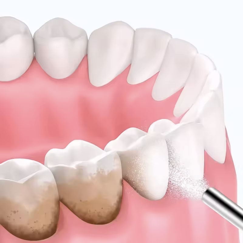 130g Dental Sandblasting Powde - Teeth Whitening Ingredients ulasan dan harga