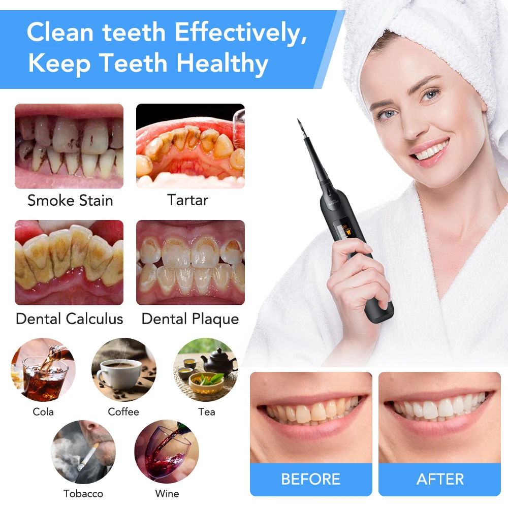 Electric Dental Scaler Toothbr - Teeth Whitening Toothbrush ulasan dan harga