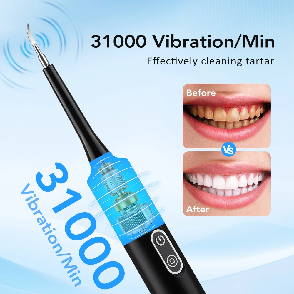 Electric Sonic Vibration Denta - Teeth Whitening Home ulasan dan harga